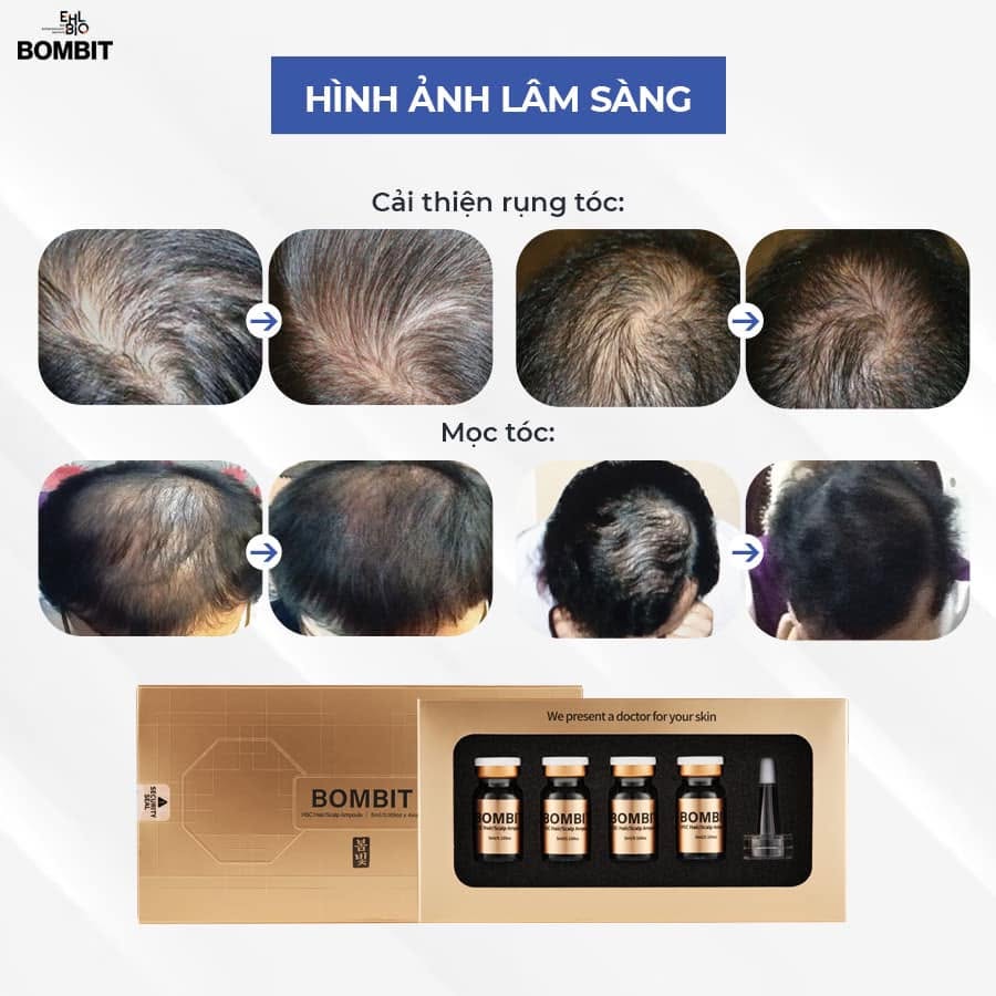 Tinh Chất Hỗ Trợ Mọc Tóc, Giảm Rụng Tóc BOMBIT Hair Meso MSC Exosome 14.jpg
