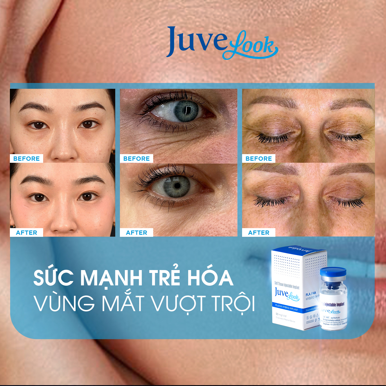 Bot-Chi-Sinh-Hoc-Tang-Sinh-Va-Tre-Hoa-Da-PDLLA-Juvelook-100mg-Han-Quoc_Bột Chỉ Sinh Học Tăng Sinh Và Trẻ Hóa Da PDLLA Juvelook 100mg Hàn Quốc3.jpg