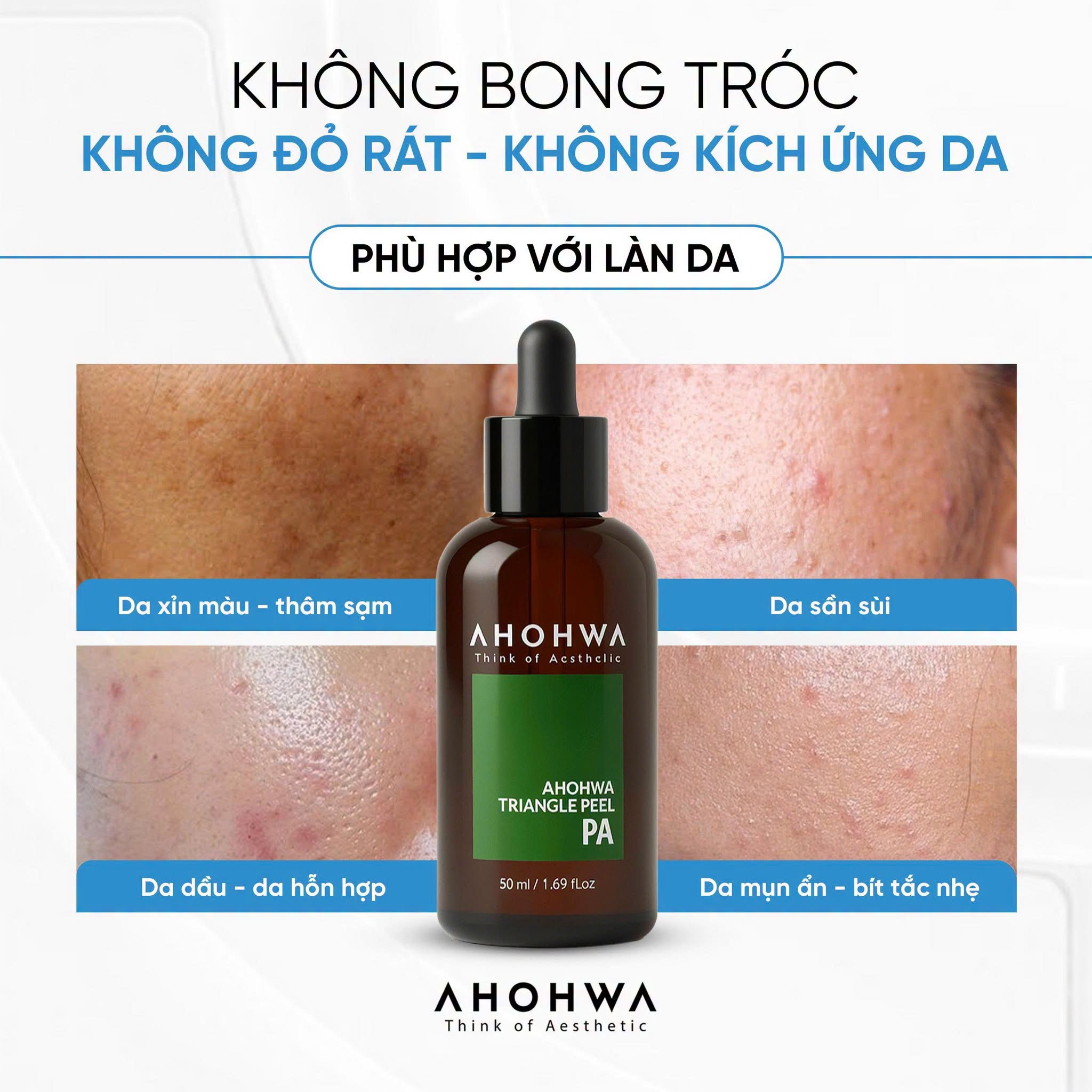 Dung dịch peel dành cho mọi loại da Ahohwa Triangle Peel Pa 10.jpg