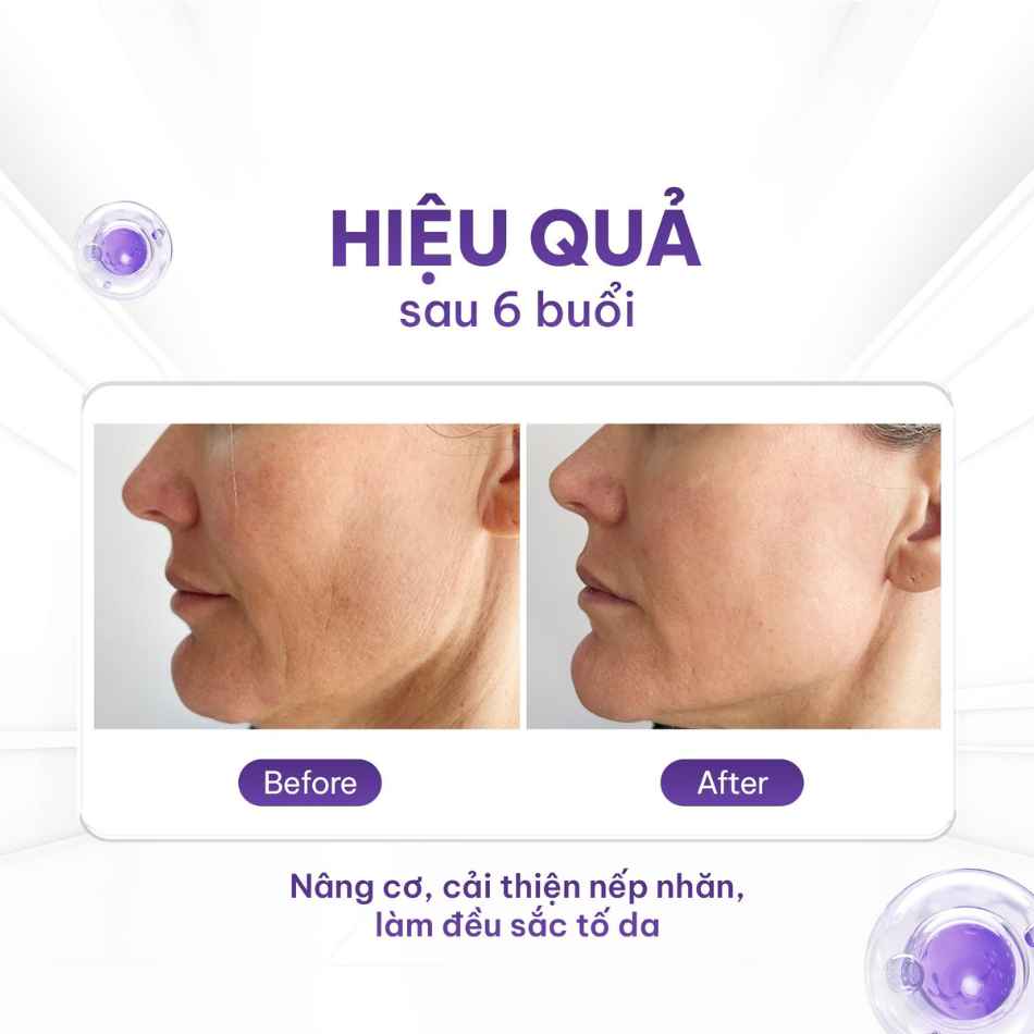 Dung dịch trẻ hóa Préime DermaCeuticals Skin Renewal Solution (3).jpg