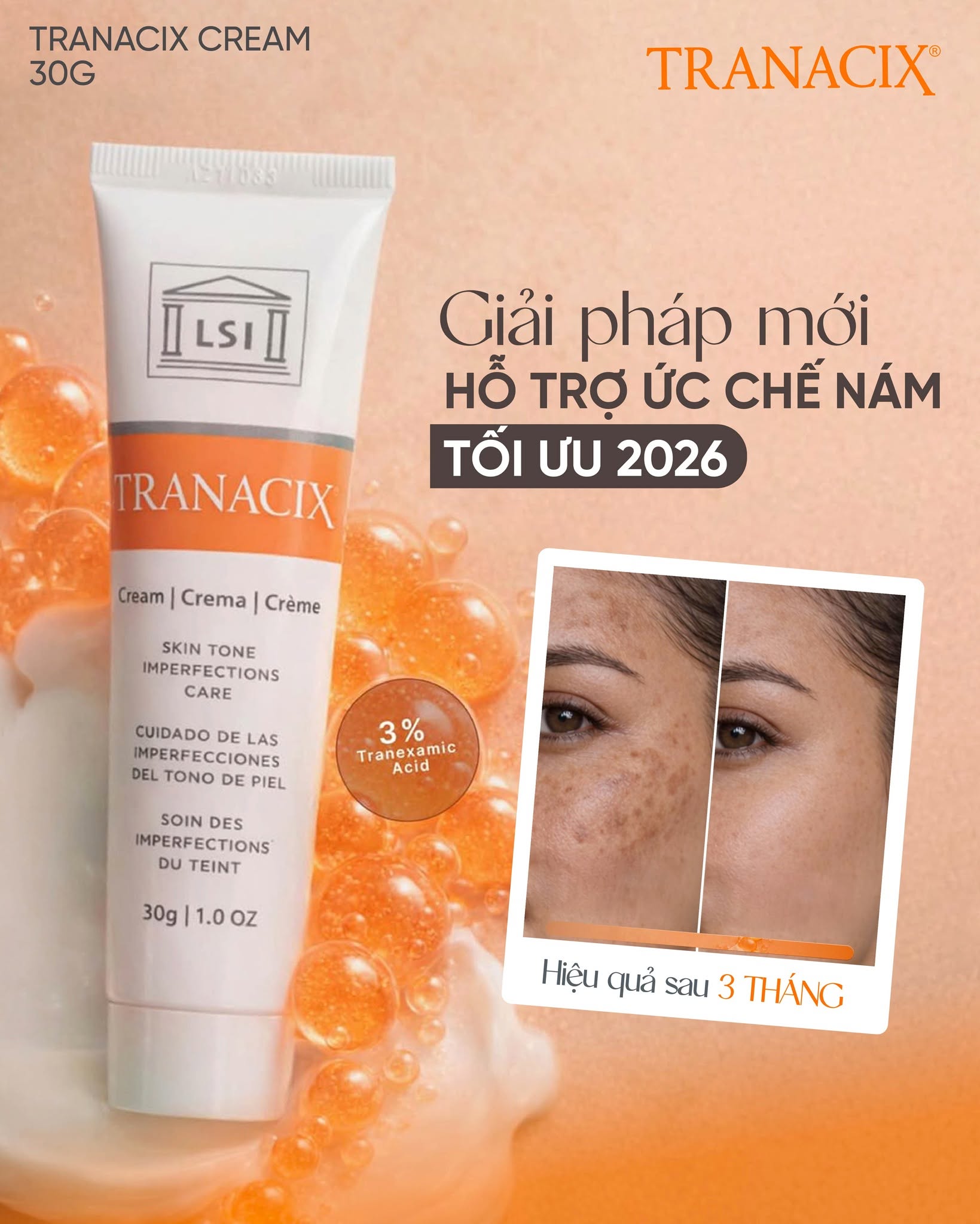 Kem Bôi Tranexamic Acid Hỗ Trợ Cải Thiện Nám, Hồng Ban Và Tăng Sắc Tố Tranacix Cream 3% 6.jpg