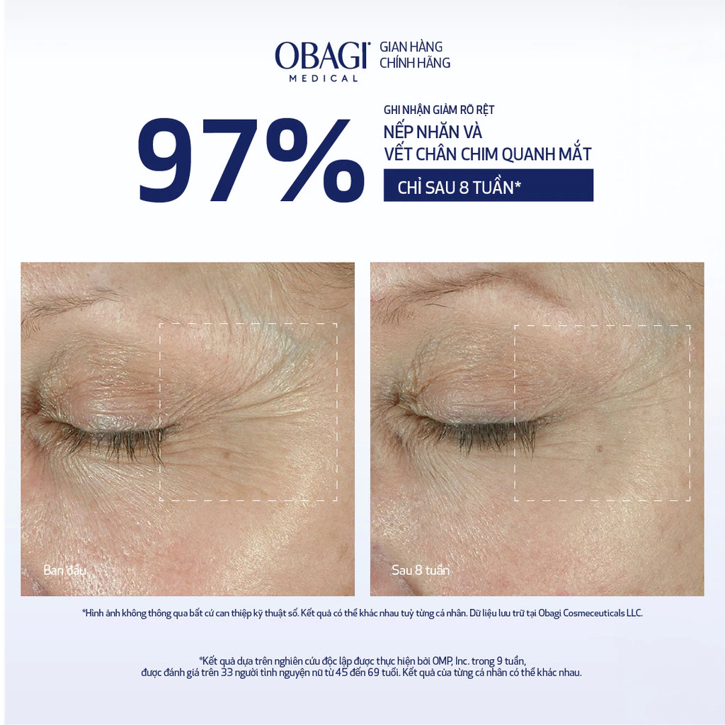 Kem dưỡng da vùng mắt ELASTIDERM® Eye Cream 15g 4.webp