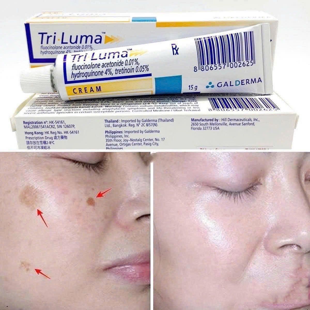 Kem-Triluma-My-tri-nam-tan-nhang-15gr_Kem Triluma Mỹ trị nám, tàn nhang 15gr (1).jpg