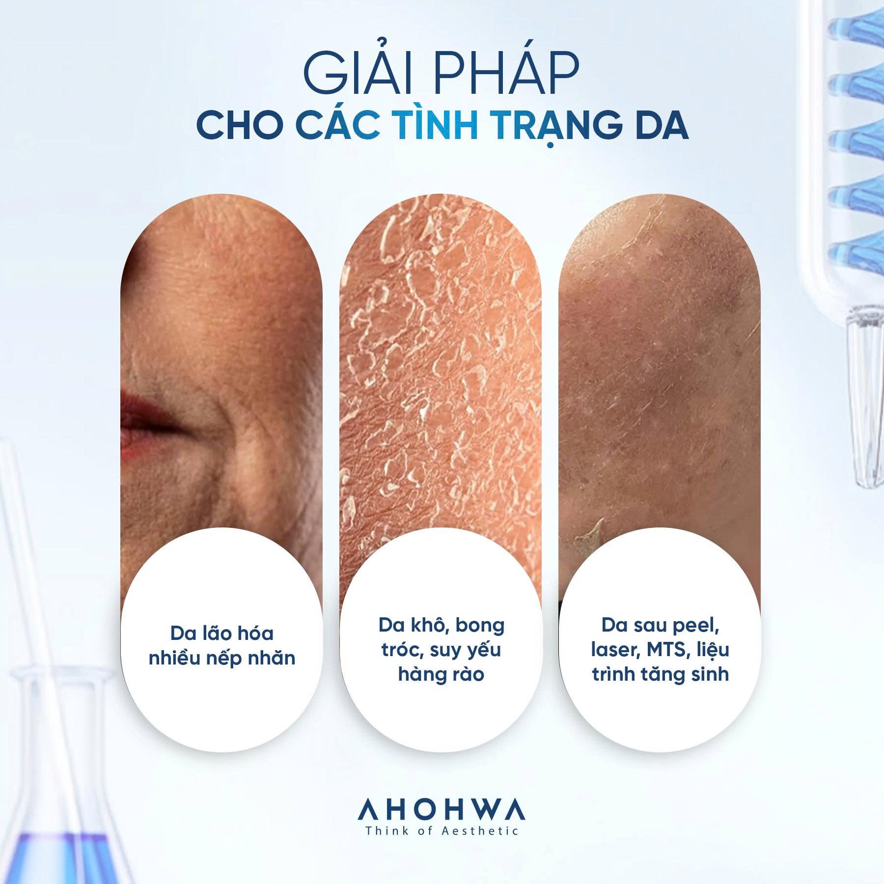Kem dưỡng botox peptide phục hồi cải thiện nếp nhăn Ahohwa Prestige Solution Peptide Hydrogel Multi Cream 4.jpg