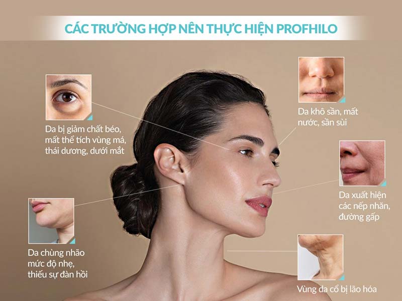Lieu-Trinh-Tiem-BAP-Profhilo-Tinh-Chat-Tre-Hoa-Va-Nang-Co-Toan-Dien-Chuan-Y-Khoa-23.jpg?v=1775274392