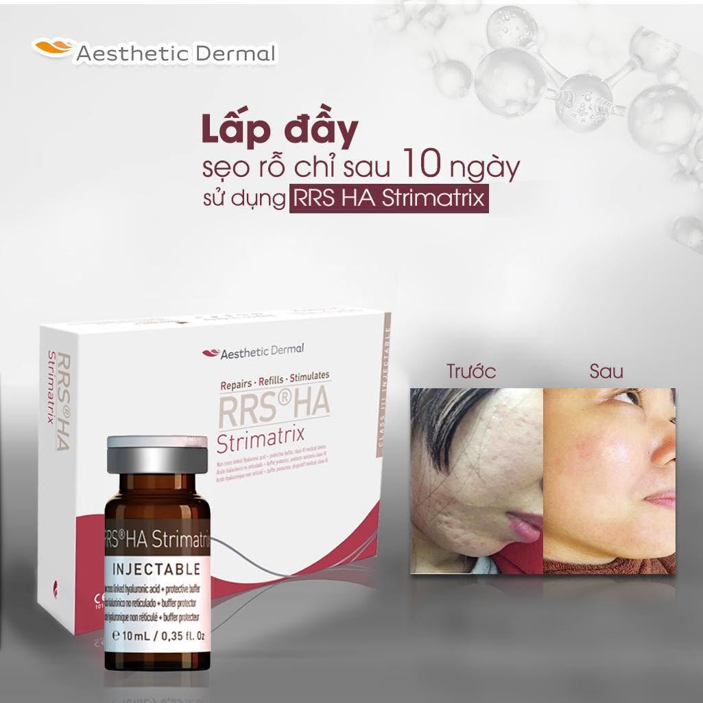 MESO TRỊ RẠN DA, SẸO RRS HA STRIMATRIX SKIN TECH 10ML 6.jpg