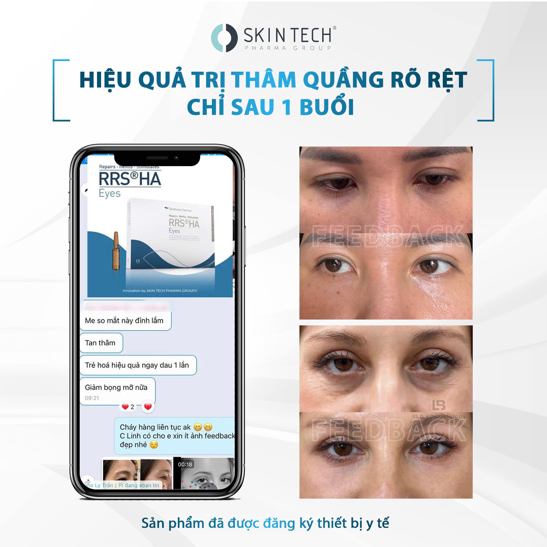 MESO-XOA-THAM-TRE-HOA-VUNG-MAT-RRS-HA-EYES-1-5ML-SKIN-TECH_MESO XOÁ THÂM, TRẺ HOÁ VÙNG MẮT RRS® HA EYES 2.jpg