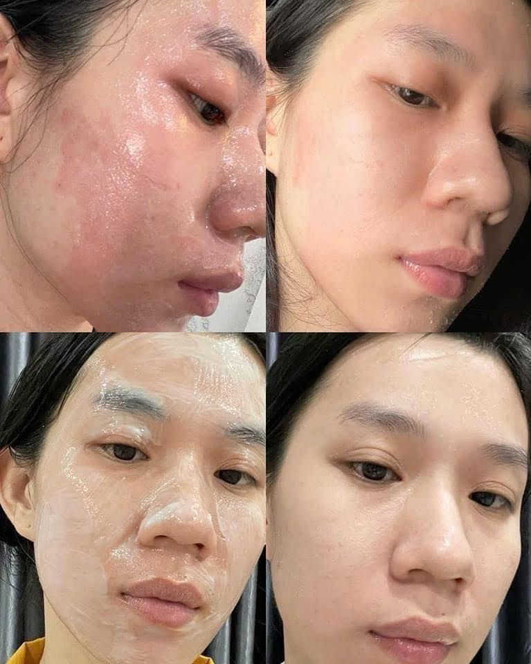 Mat-Na-Duong-Am-Phuc-Hoi-Da-Christina-Unstress-8-Optimal-Hydration-Mask-250ml_Mặt Nạ Dưỡng Ẩm Phục Hồi Da Christina Unstress 8 Optimal Hydration Mask 250ml 2.jpg