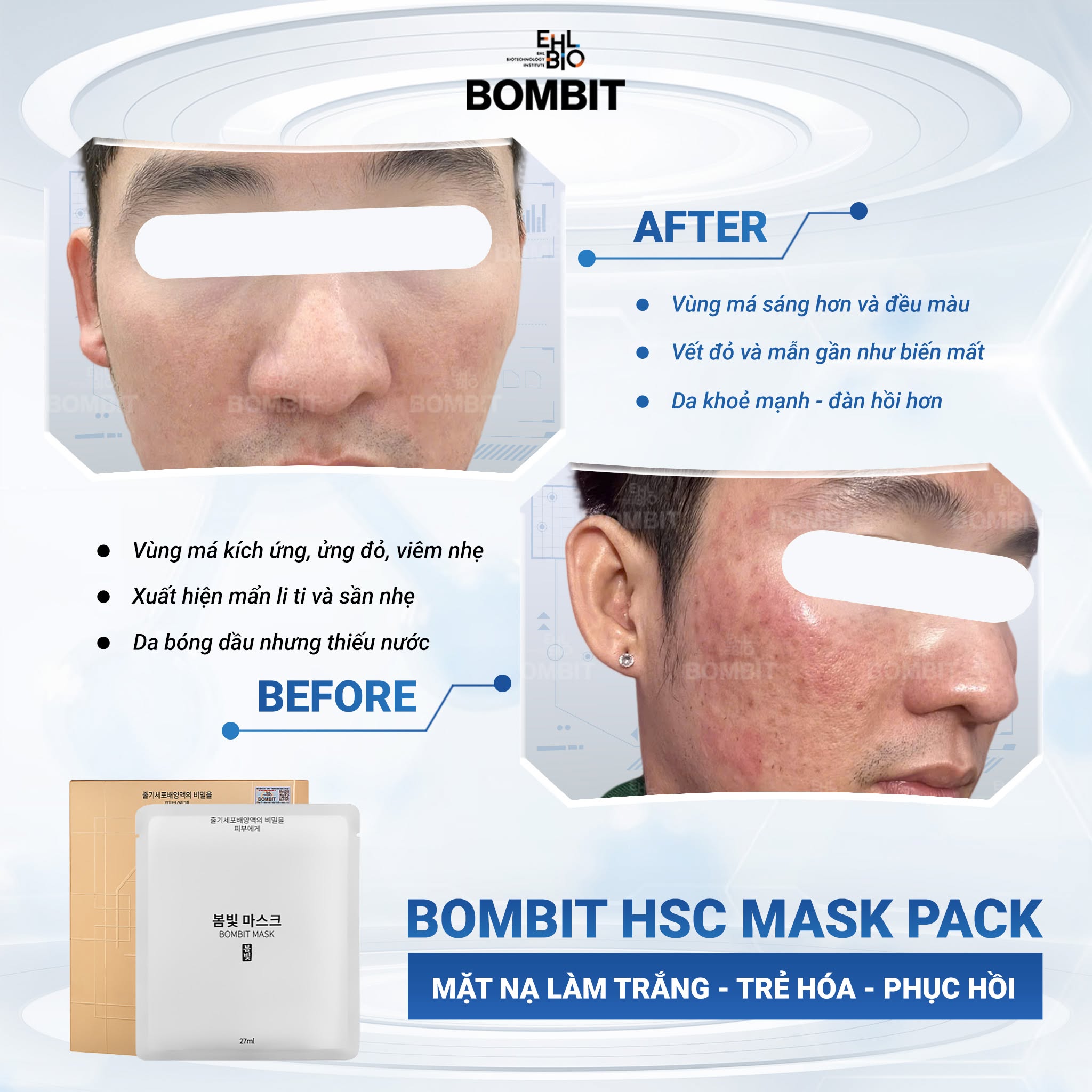 Mặt nạ Bombit Exosome làm trắng, phục hồi, tái tạo da.jpg