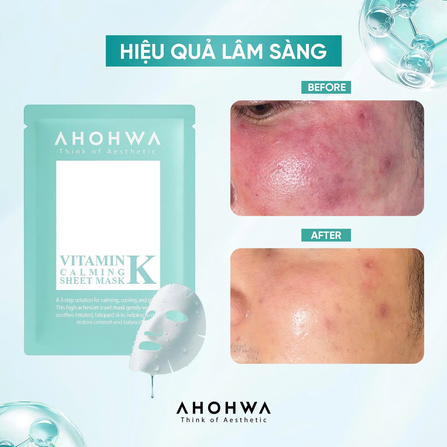 Ahohwa Vitamin K Calming Sheet Mask 12.jpg