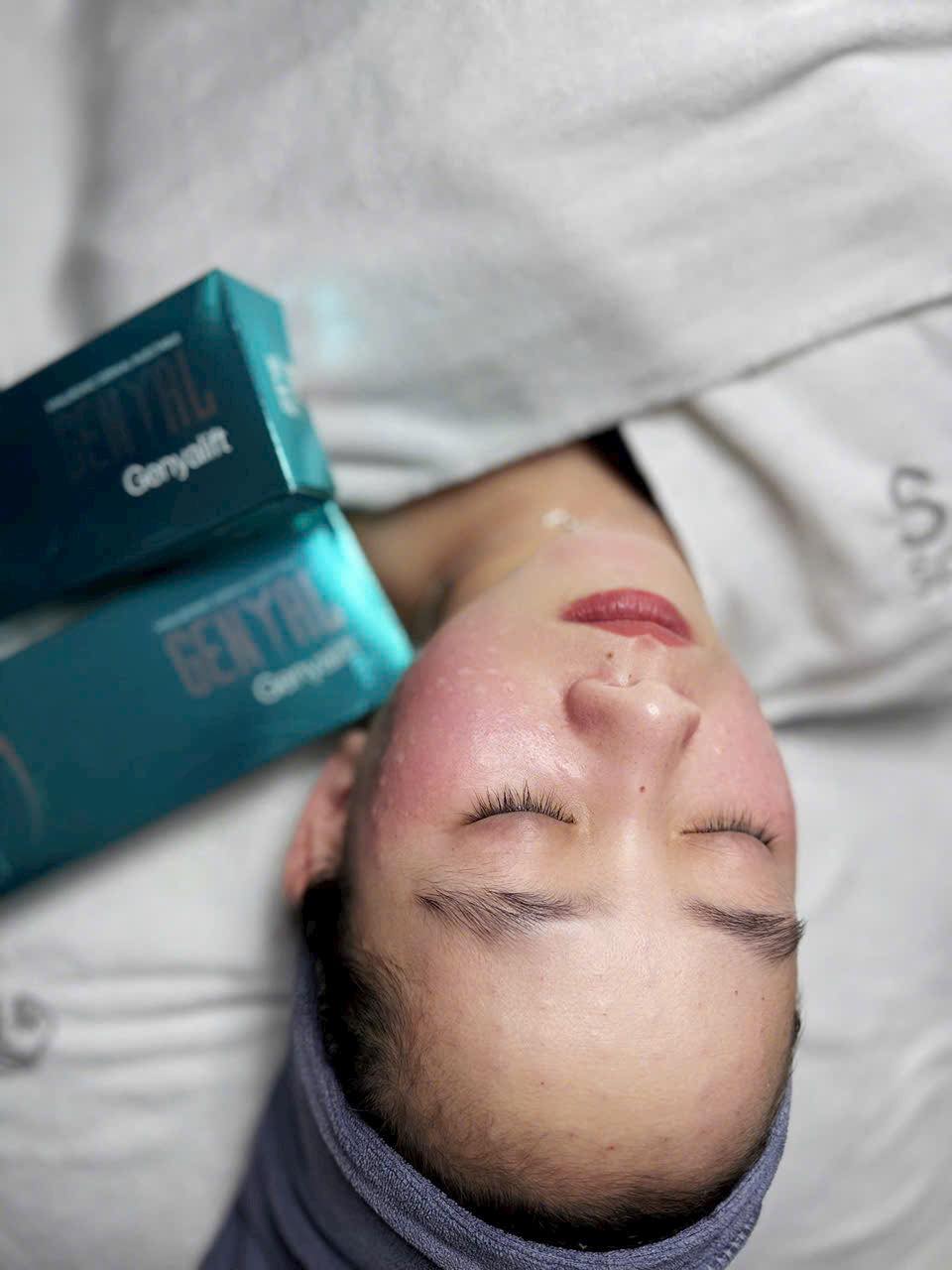 Meso-Genyalift-Skin-Booster-thu-nho-lo-chan-long-tre-hoa-Genyal-Thuy-Si-1-lo_Meso Genyalift – Skin Booster thu nhỏ lỗ chân lông, trẻ hóa Genyal Thuỵ Sĩ - 1 lọ.jpg