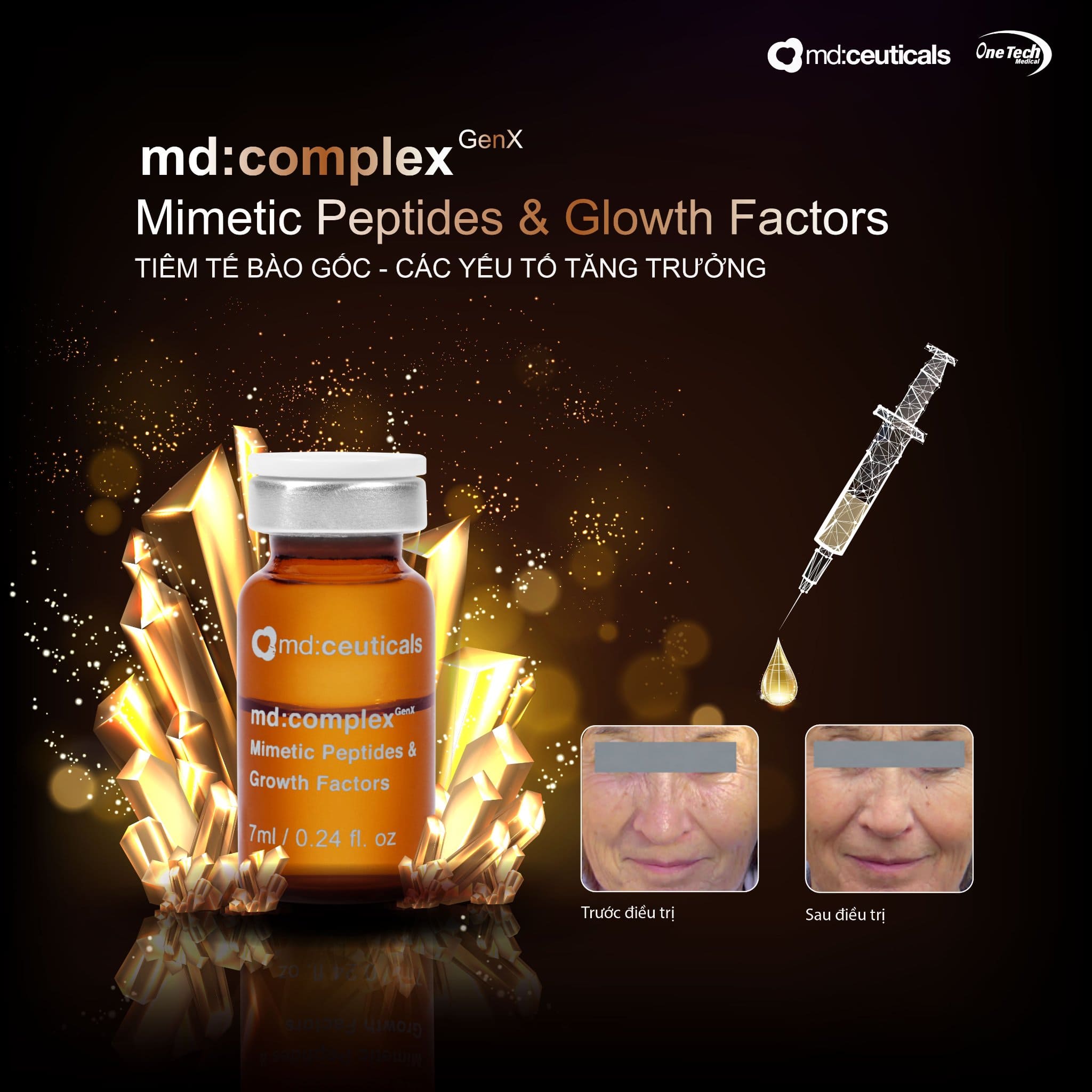 Meso-te-bao-goc-Md-Complex-Genx-Mimetic-Peptide-amp-Growth-Factors-MD-Ceuticals-7ml_Meso tế bào gốc (1).jpg