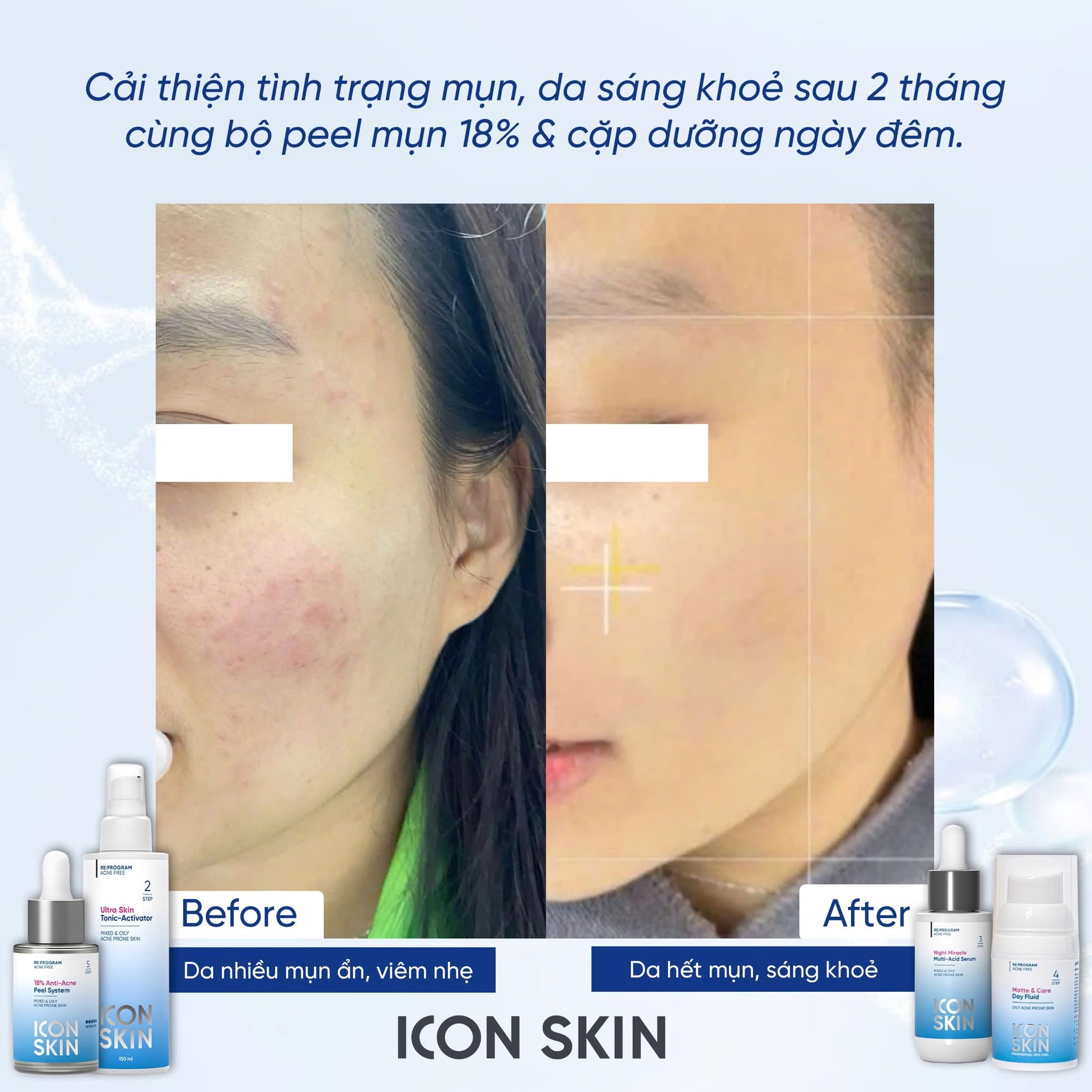 Nước cân bằng cho da dầu, da hỗn hợp Icon Skin Ultra Skin Tonic-Activator 6.jpg