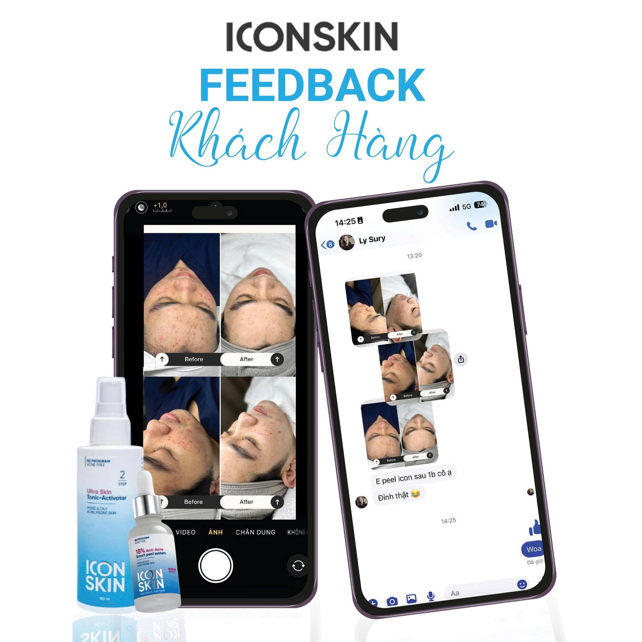 Nước cân bằng cho da dầu, da hỗn hợp Icon Skin Ultra Skin Tonic-Activator 8.jpg