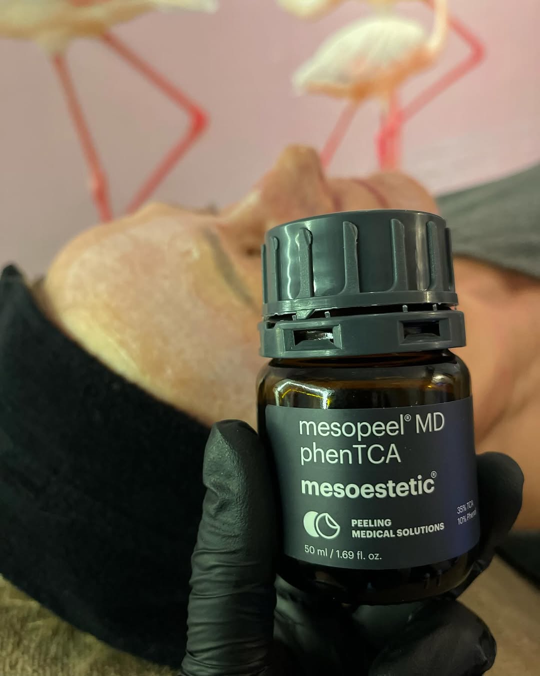 PEEL-DIEU-TRI-SAC-TO-CHUYEN-SAU-MESOPEEL-MD-MELANOSTOP-TRANEX_PEEL ĐIỀU TRỊ SẮC TỐ CHUYÊN SÂU MESOPEEL MD MELANOSTOP.jpg