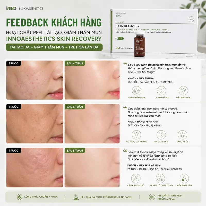 Hoạt Chất Peel Tái Tạo, Giảm Thâm Mụn, Trẻ Hóa Da INNOAESTHETICS Skin Recovery 1 lọ.webp