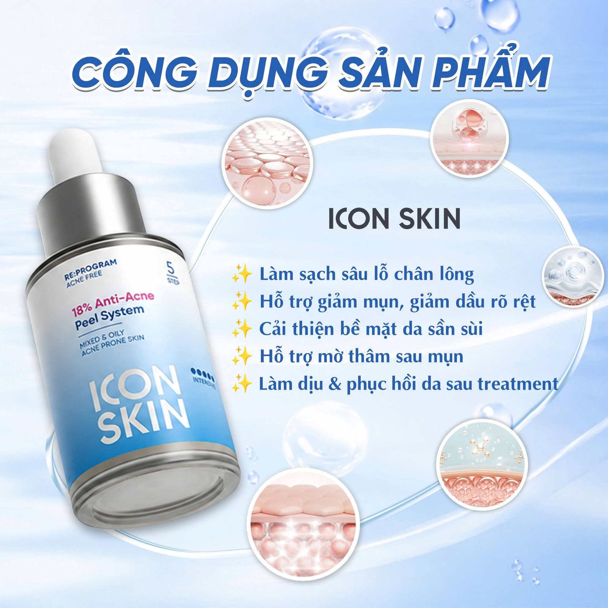 Peel da không bong cho da dầu, da hỗn hợp Icon Skin 18% Anti-Acne Peel System 2.jpg