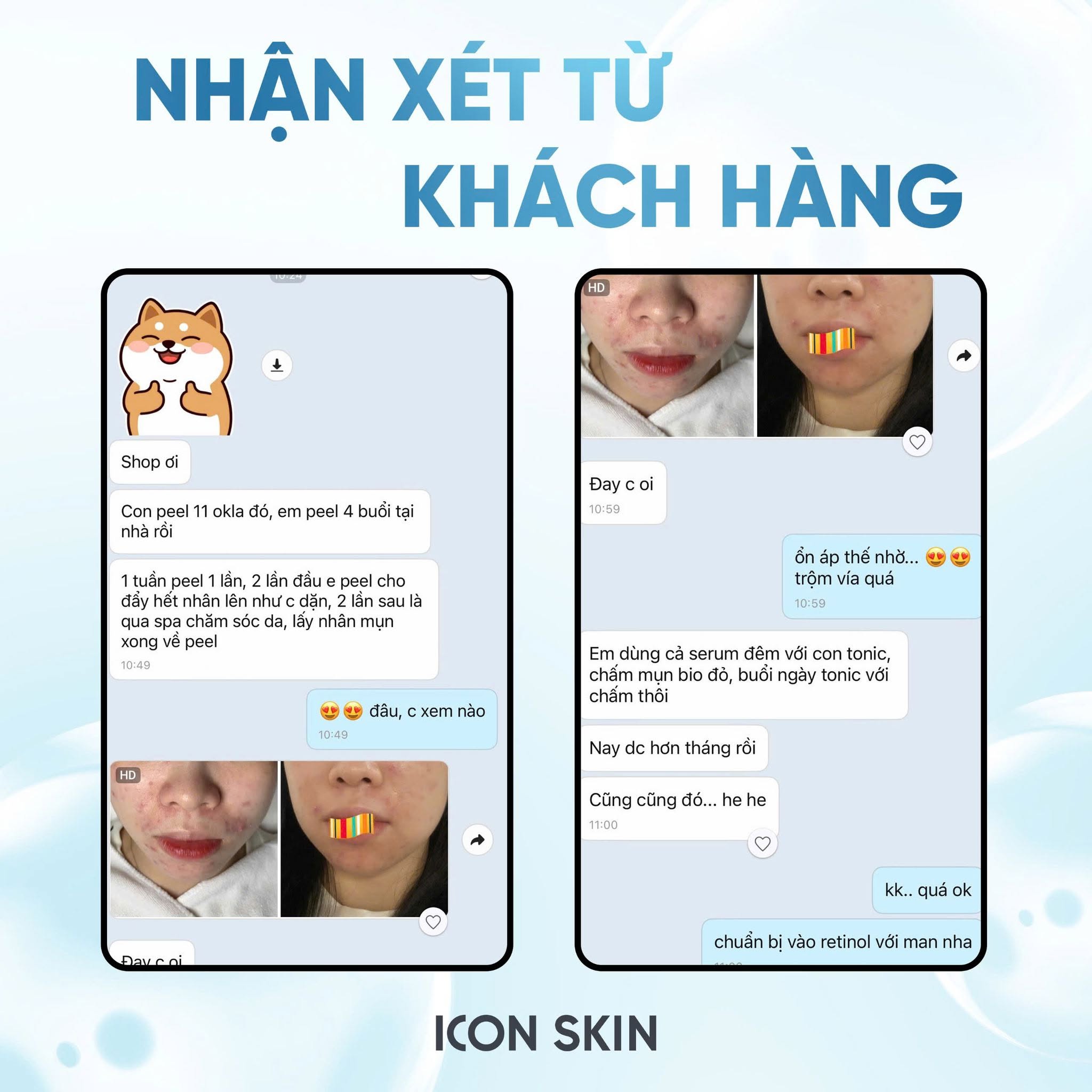 Peel da không bong cho da nhiễm corticoid, da nhạy cảm Icon Skin 11% Anti-Acne Peel System 3.jpg