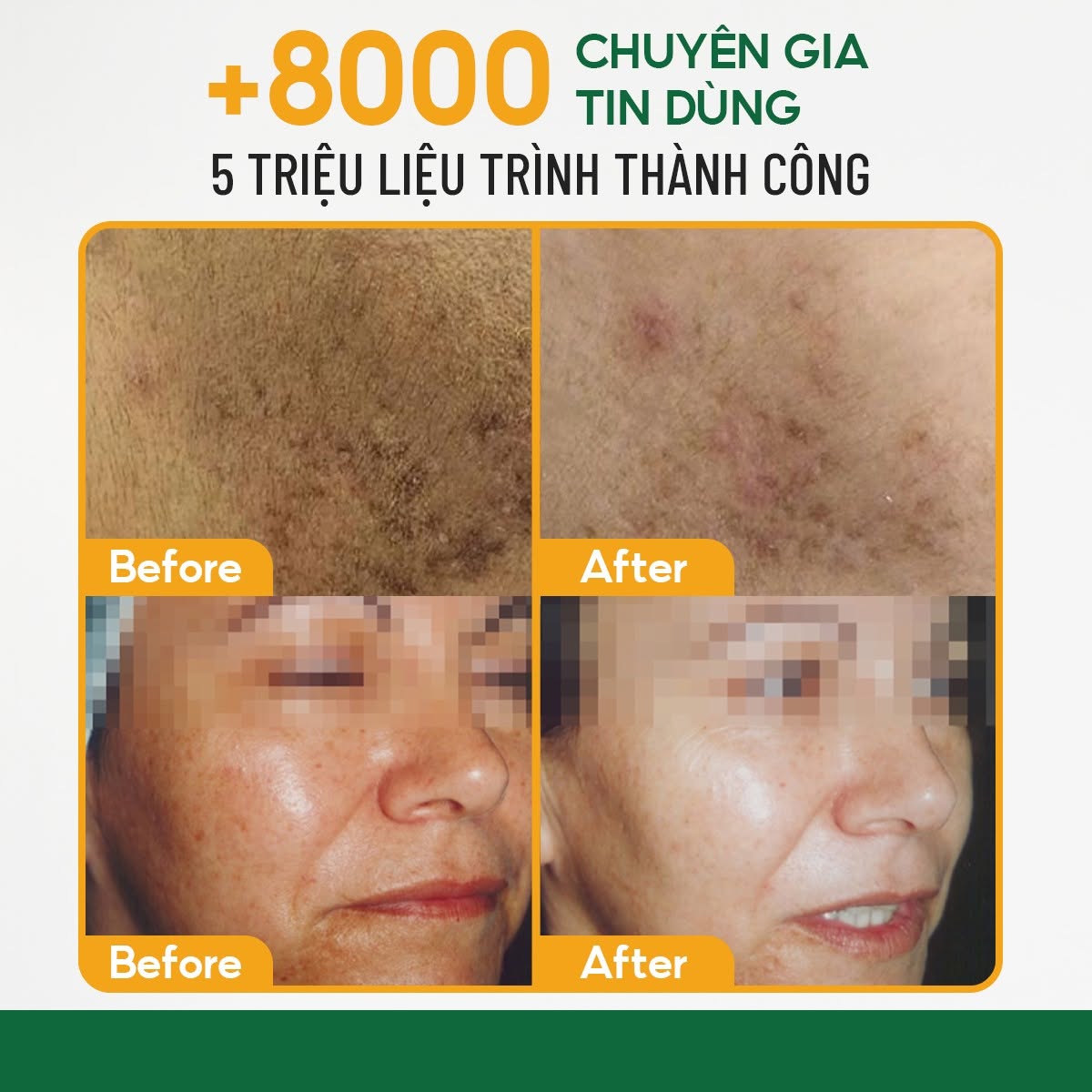 Peel Innoaesthetics Lightening 3.jpg
