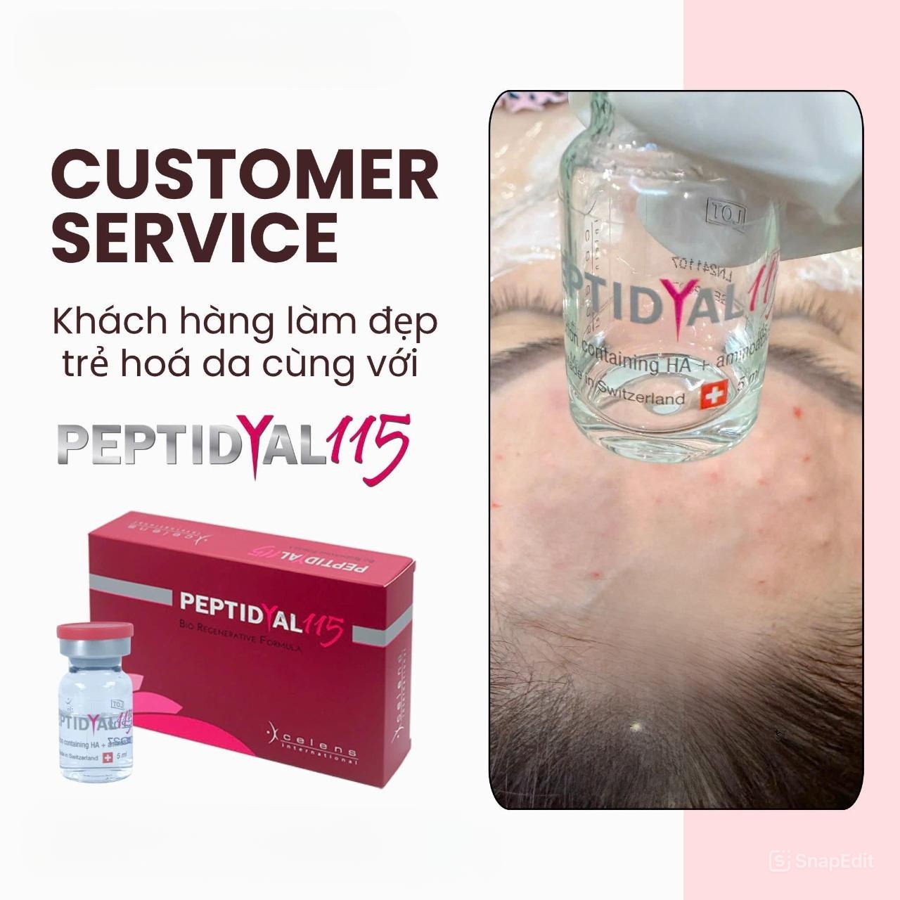 Peptidyal-115-Meso-cocktail-tre-hoa-va-cang-bong-da-Thuy-Si-1-lo_Peptidyal 115 – Meso cocktail trẻ hóa và căng bóng da Thuỵ Sĩ 1 lọ (2).jpg
