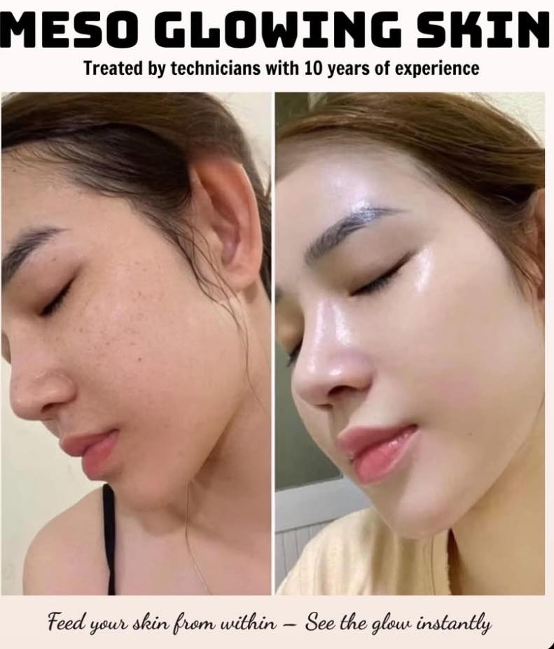 Peptidyal-115-Meso-cocktail-tre-hoa-va-cang-bong-da-Thuy-Si-1-lo_Peptidyal 115.jpg