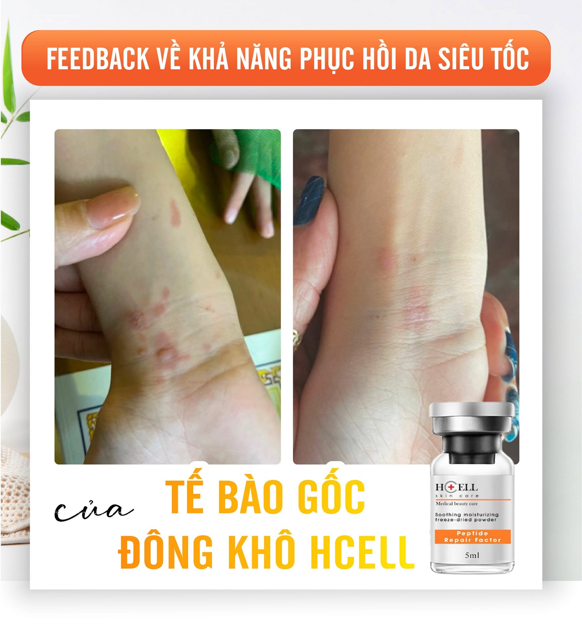 Tế Bào Gốc Hcell Đông Khô Peptide Repair Factor nuôi dưỡng, tái tạo phục hồi da 7.jpg