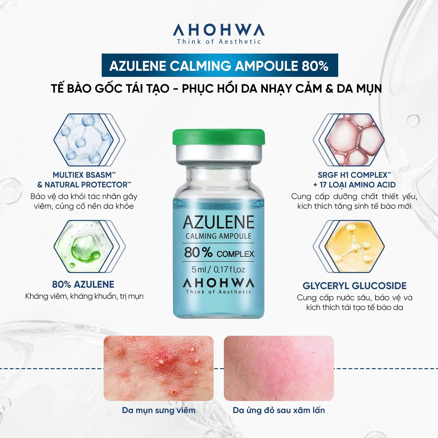 Tế bào gốc kháng viêm phục hồi tái tạo da mụn Ahohwa Azulene Calming Ampoule 80% 6.jpg