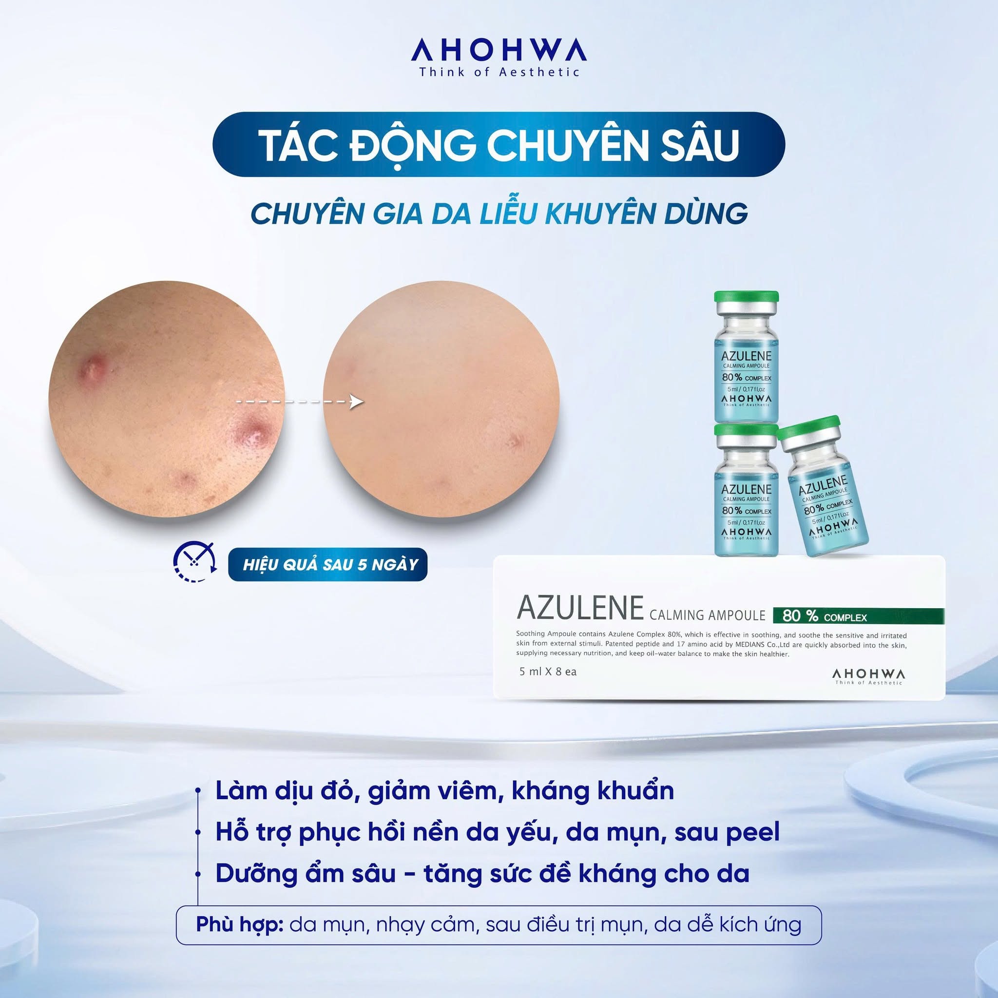 Tế bào gốc kháng viêm phục hồi tái tạo da mụn Ahohwa Azulene Calming Ampoule 80% 5.jpg