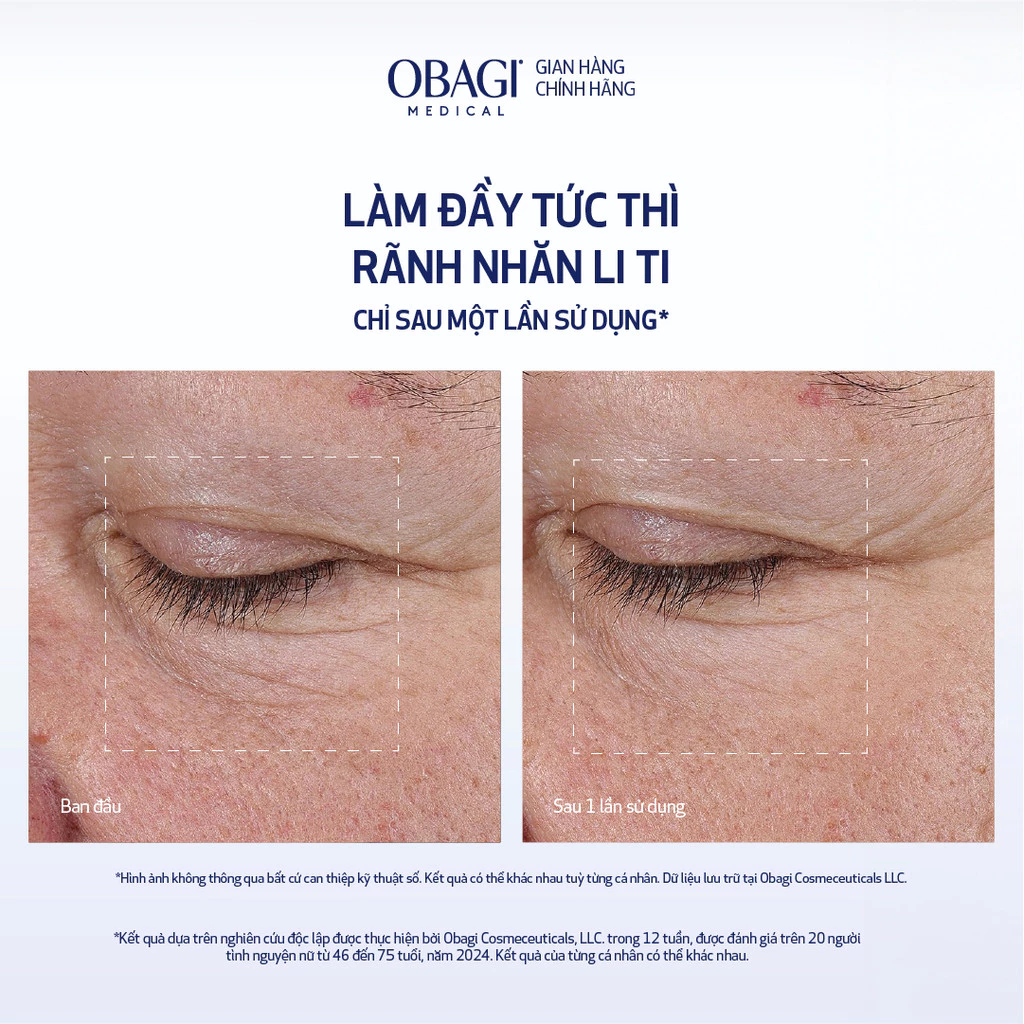Tinh Chất Làm Mờ Nếp Nhăn Obagi ELASTIderm® Advanced Filler Concentrate 20ml 4.webp