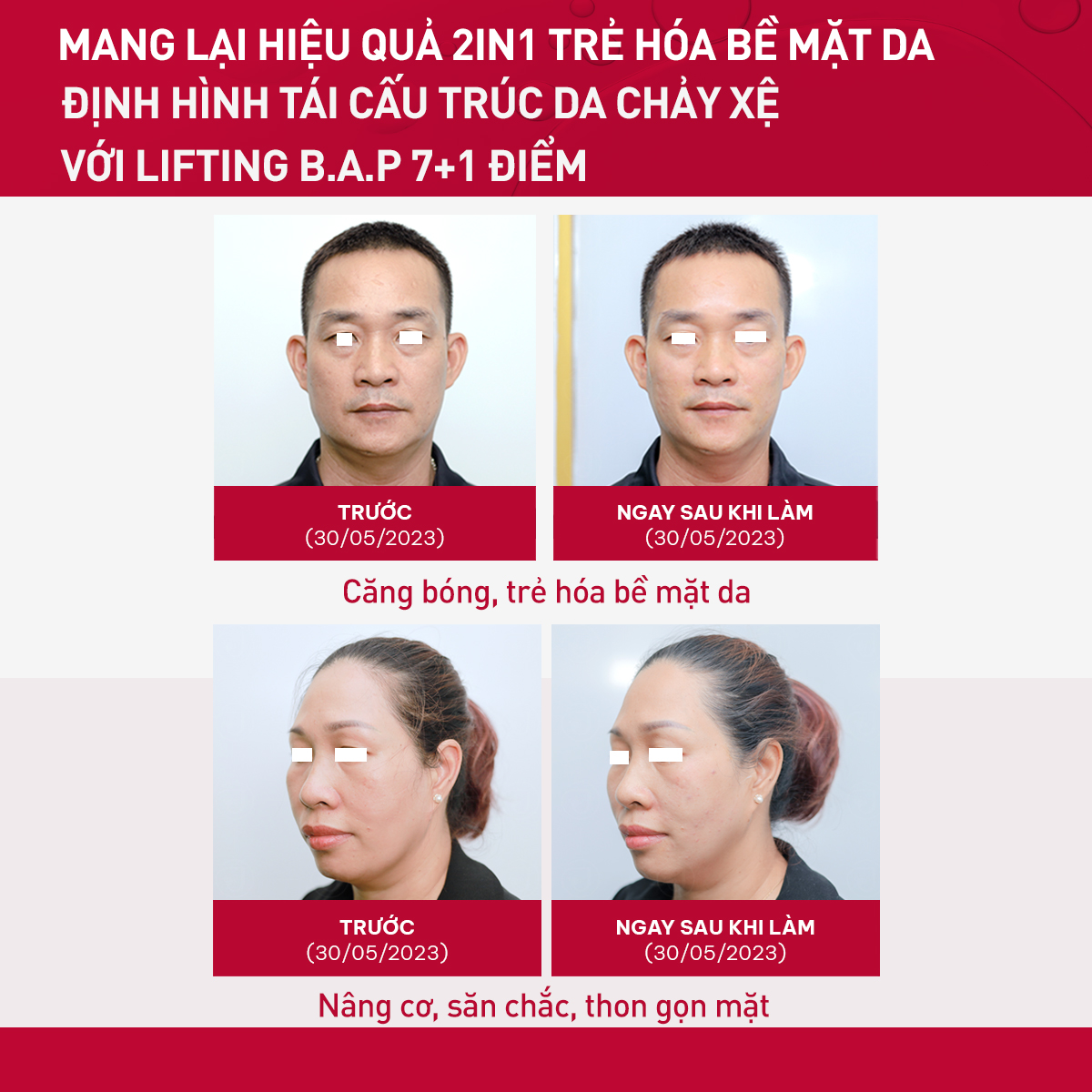 Tinh-Chat-Tre-Hoa-Da-Toan-Dien-French-Beauty-FL-EraHA-3ml-Phap_Tinh Chất Trẻ Hoá Da Toàn Diện French Beauty FL-EraHA 3ml - Pháp 1.jpg