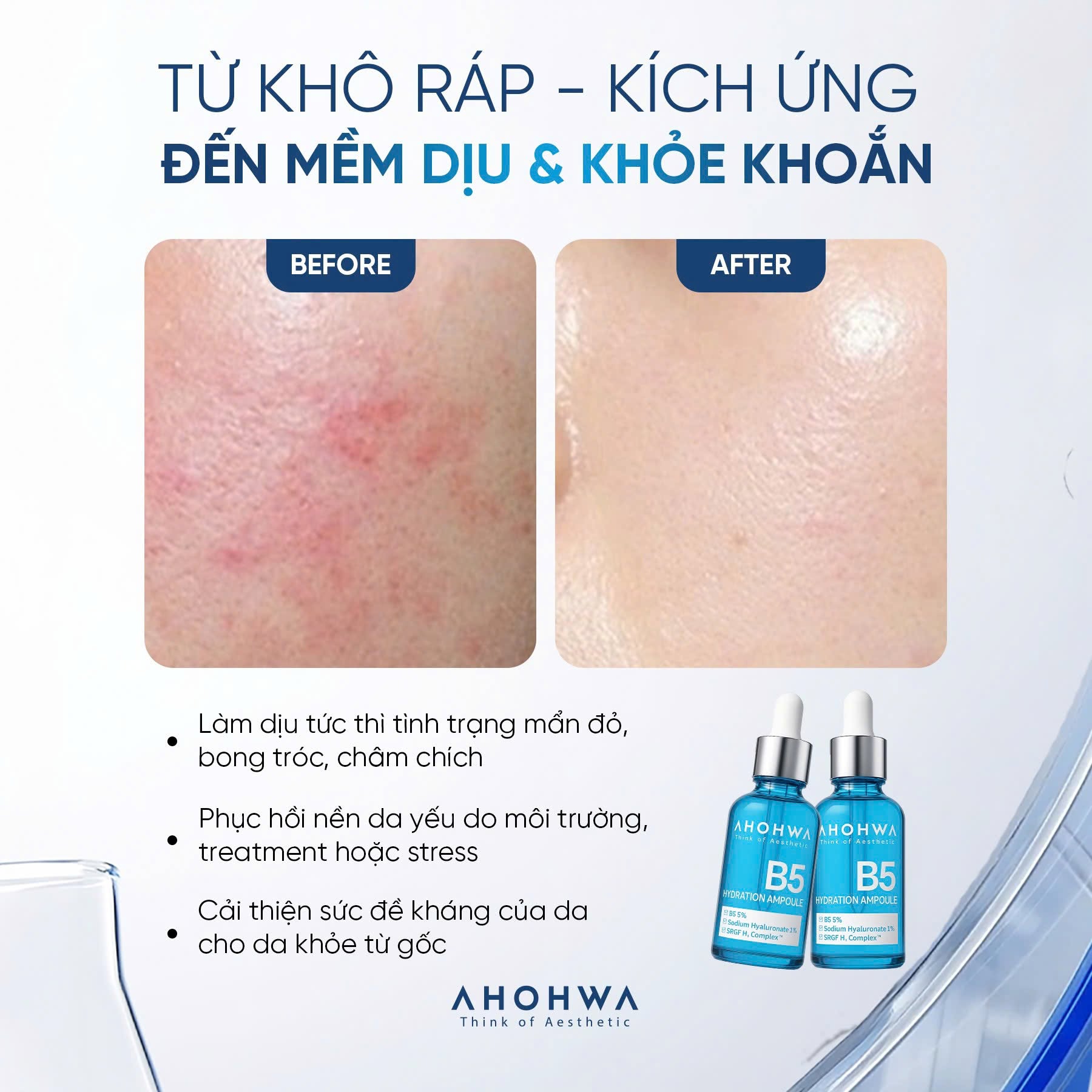 Tinh chất ampoule B5 cấp ẩm phục hồi da Ahohwa Hydration Ampoule B5 12.jpg