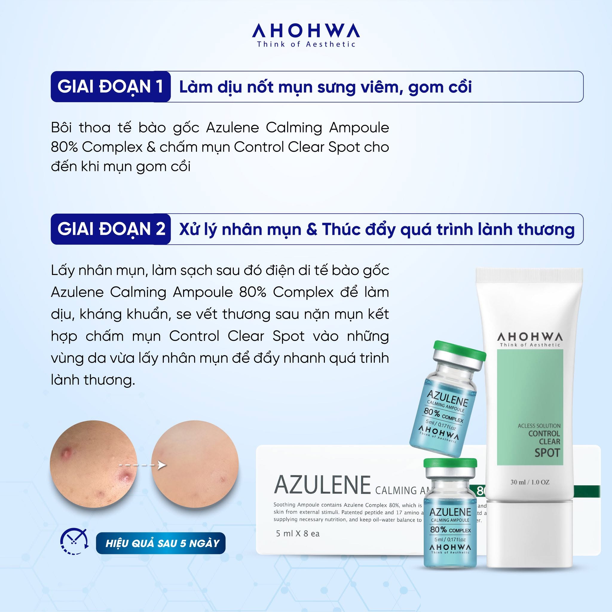 Tinh chất chấm mụn giảm viêm Ahohwa Acless Solution Control Clear Spot 4.jpg
