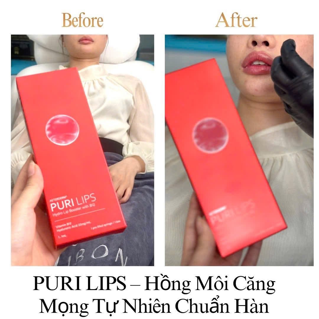 Tinh chất hồng môi Puri Lips 1.jpg