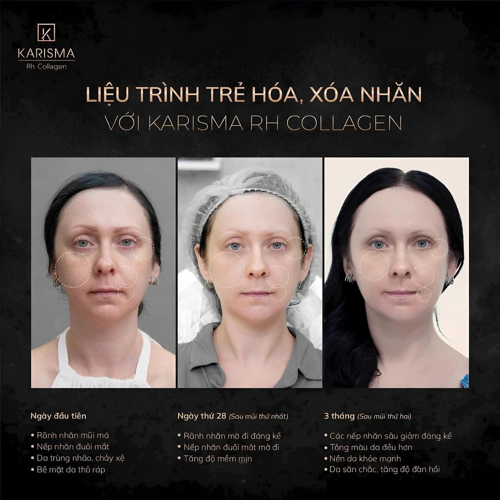 Tinh chất trẻ hóa da KARISMA Rh Collagen