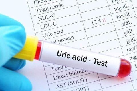 Nguyên nhân gây tăng Axit Uric trong máu và biện pháp khắc phục hiệu quả