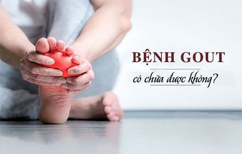 Bệnh gout có chữa được không? Những biện pháp phòng ngừa bệnh gout