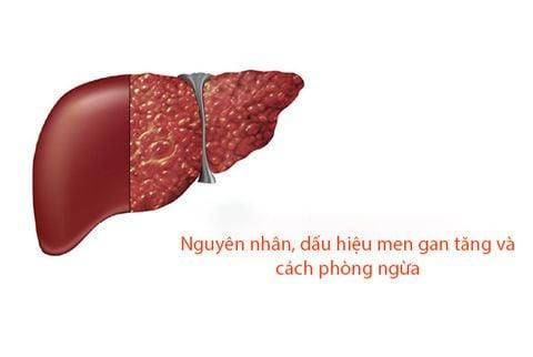 Dấu hiệu men gan tăng và cách phòng ngừa