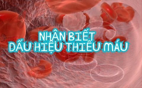 Dấu hiệu thiếu máu: Nhận biết và hành động kịp thời