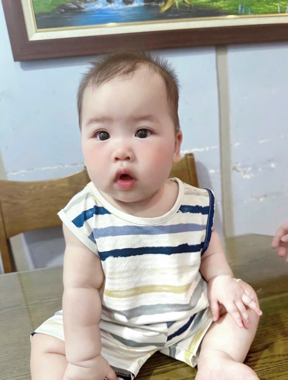 L41 SET 3 BỘ THÔNG HƠI CHO BÉ