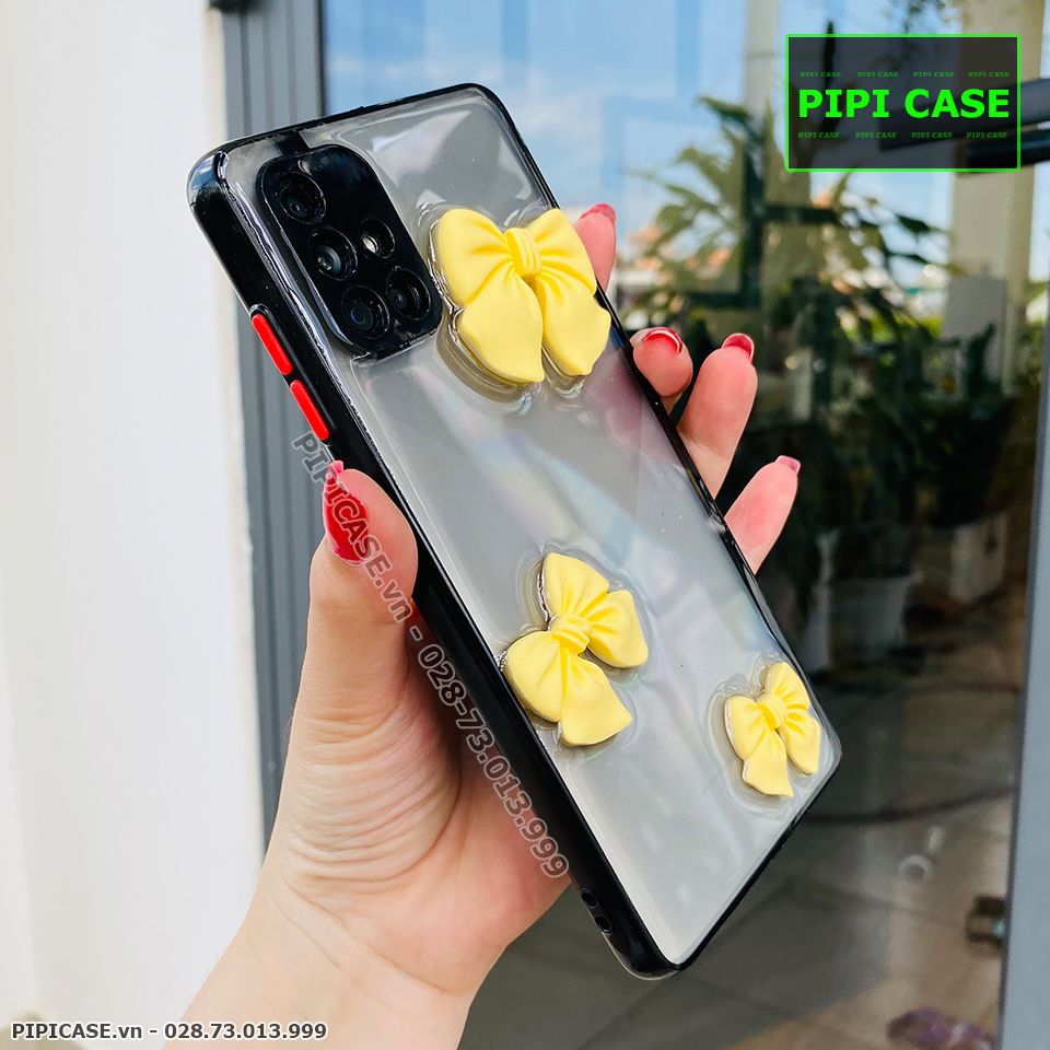 Ốp Lưng Samsung A51 - Anime - Vàng