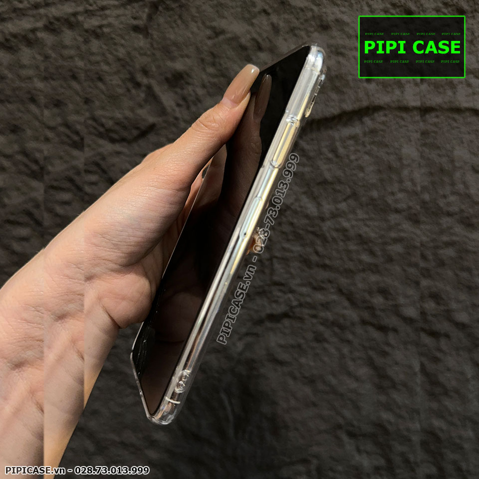 Ốp Lưng iPhone X / XS - Ping - Trắng