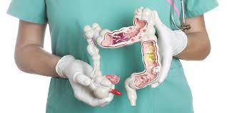 Tìm hiểu bệnh đường ruột nên ăn gì và không nên ăn gì