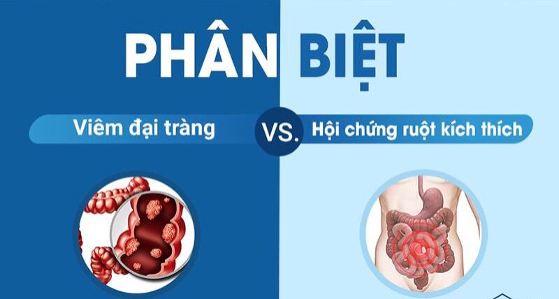 PHÂN BIỆT VIÊM ĐẠI TRÀNG VÀ HỘI CHỨNG RUỘT KÍCH THÍCH