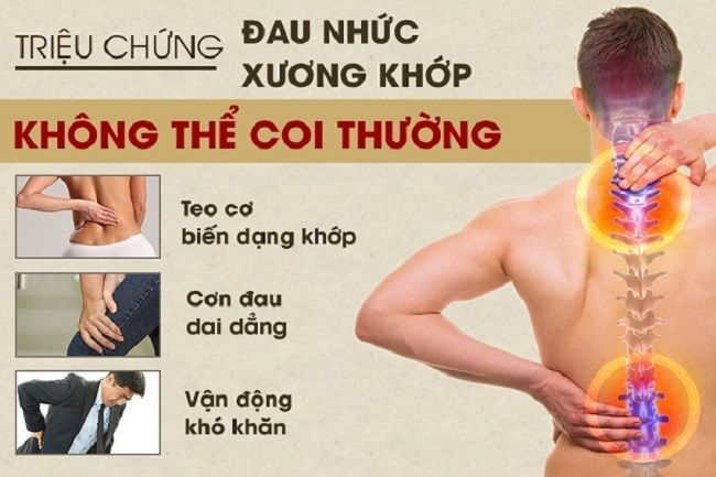 viên bổ khớp