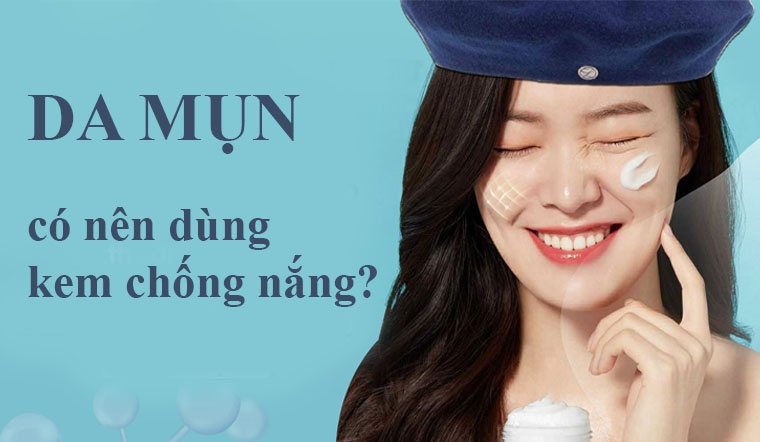 Da bị mụn có nên dùng kem chống nắng không?