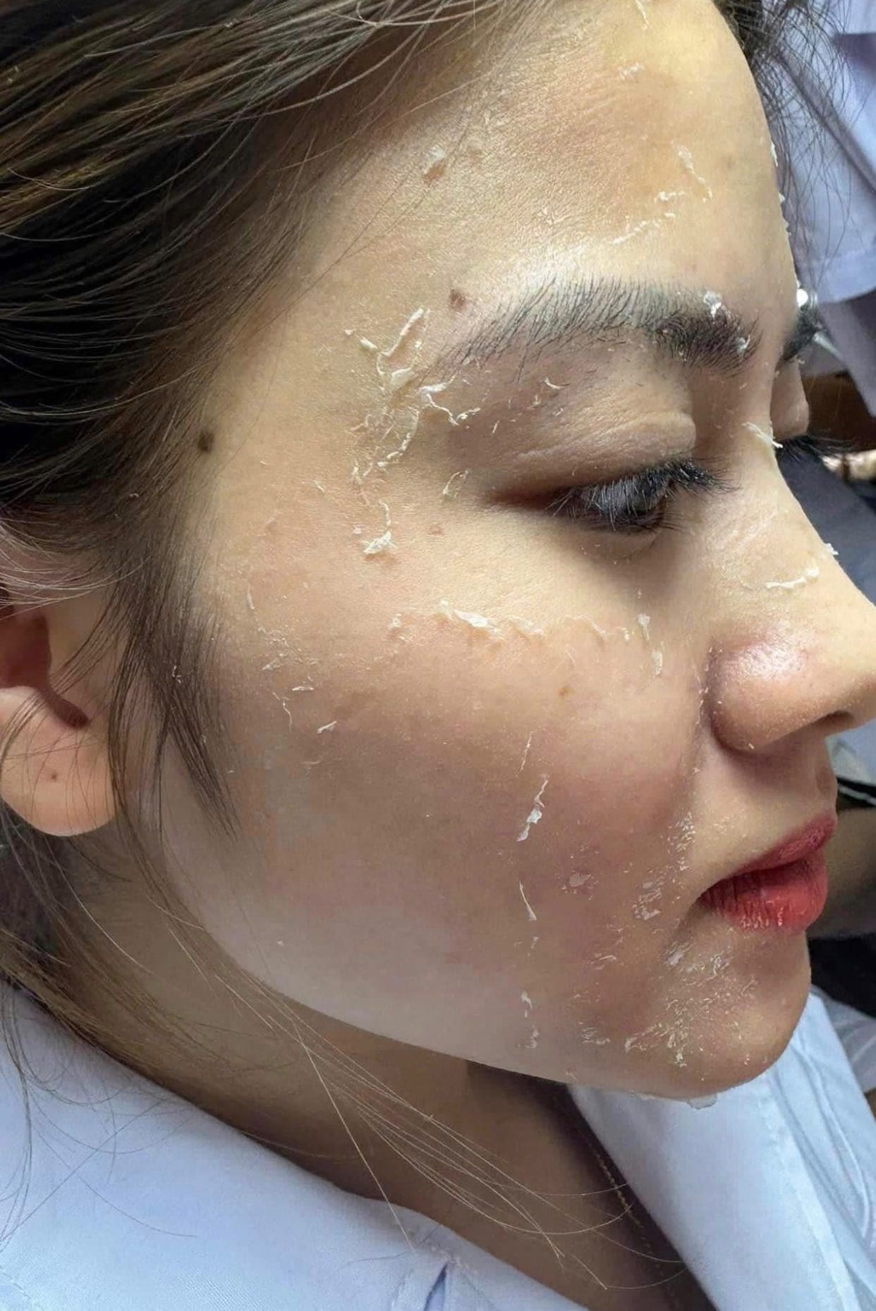 Cach-peel-da-tai-nha-an-toan-cho-nguoi-moi-bat-dau_Cách peel da tại nhà an toàn cho người mới bắt đầu 1.jpg