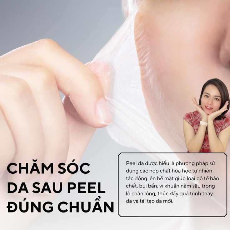 Chemical-Peel-Peel-Da-Hoa-Hoc-Giup-Tai-Tao-Da-Giam-Tham-Mo-Nam-Hieu-Qua_Chemical Peel (Peel da hóa học) 2.jpg