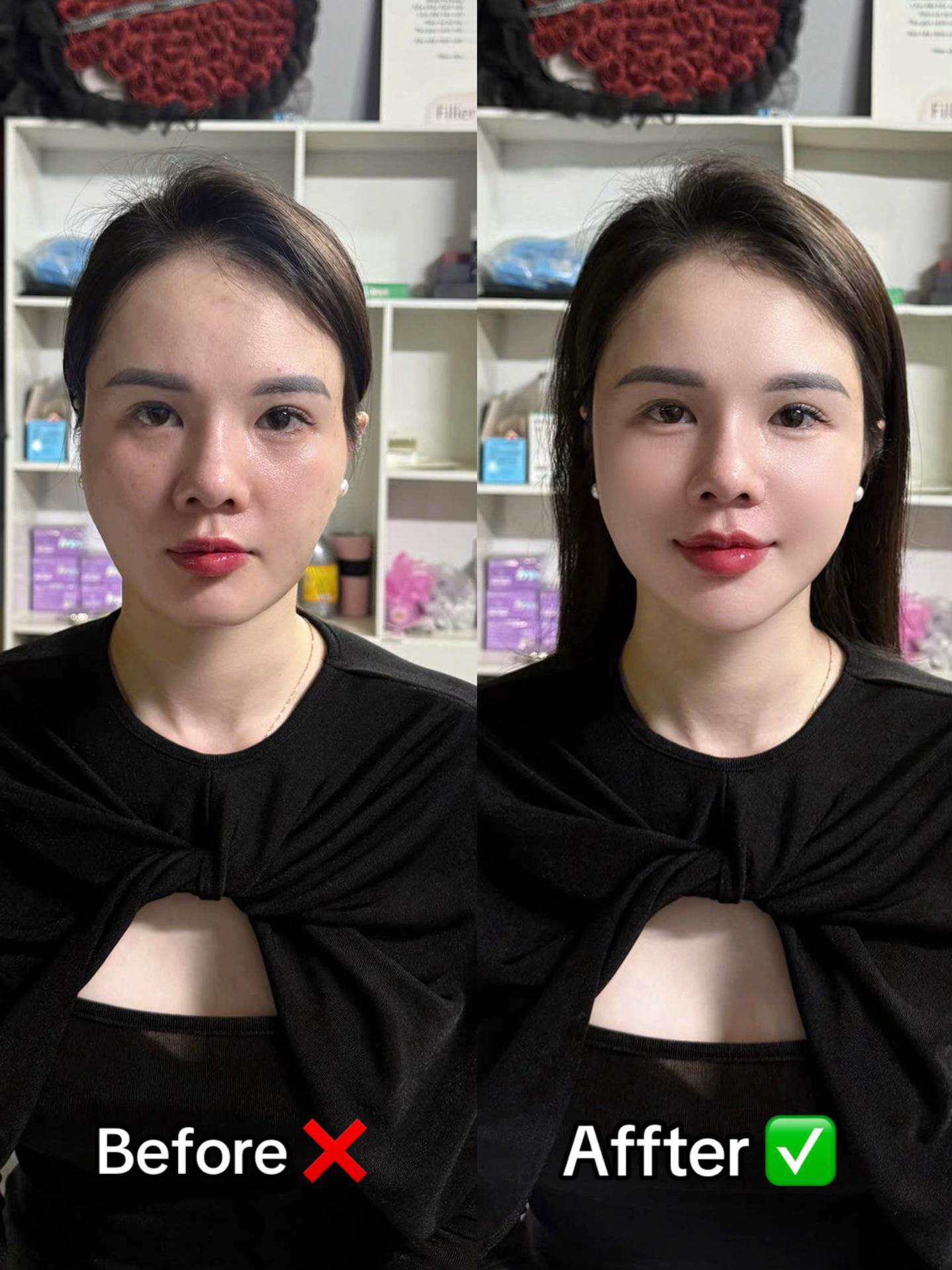 Chinh-Sua-Full-Face-Co-Bi-Do-Gia-Khong--1.jpg