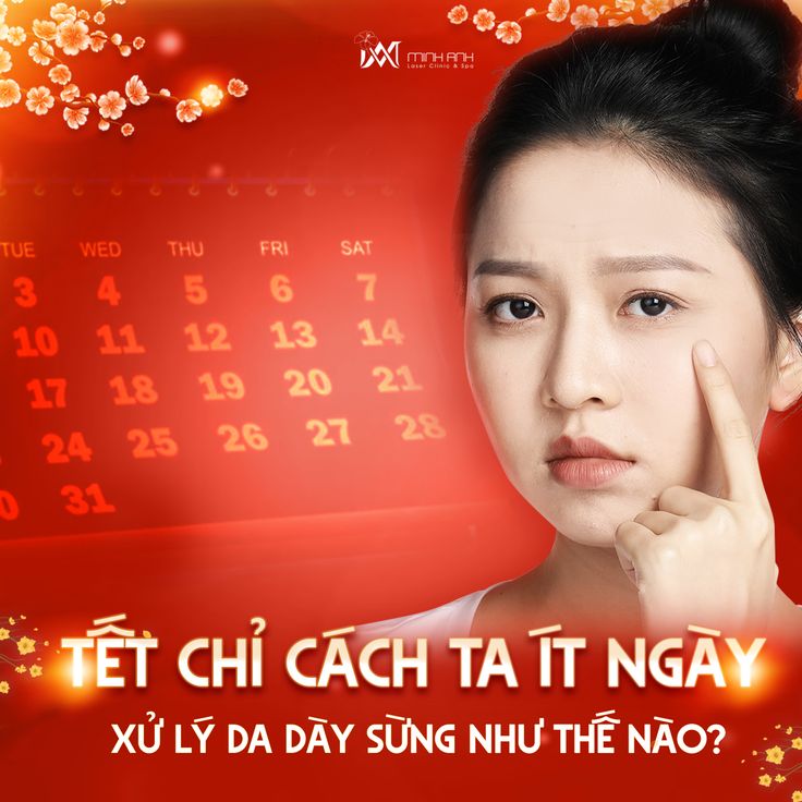 Cuoi-Nam-Ban-Ron-Lam-Sao-De-Van-Dep-Don-Tet-2026--1.jpg