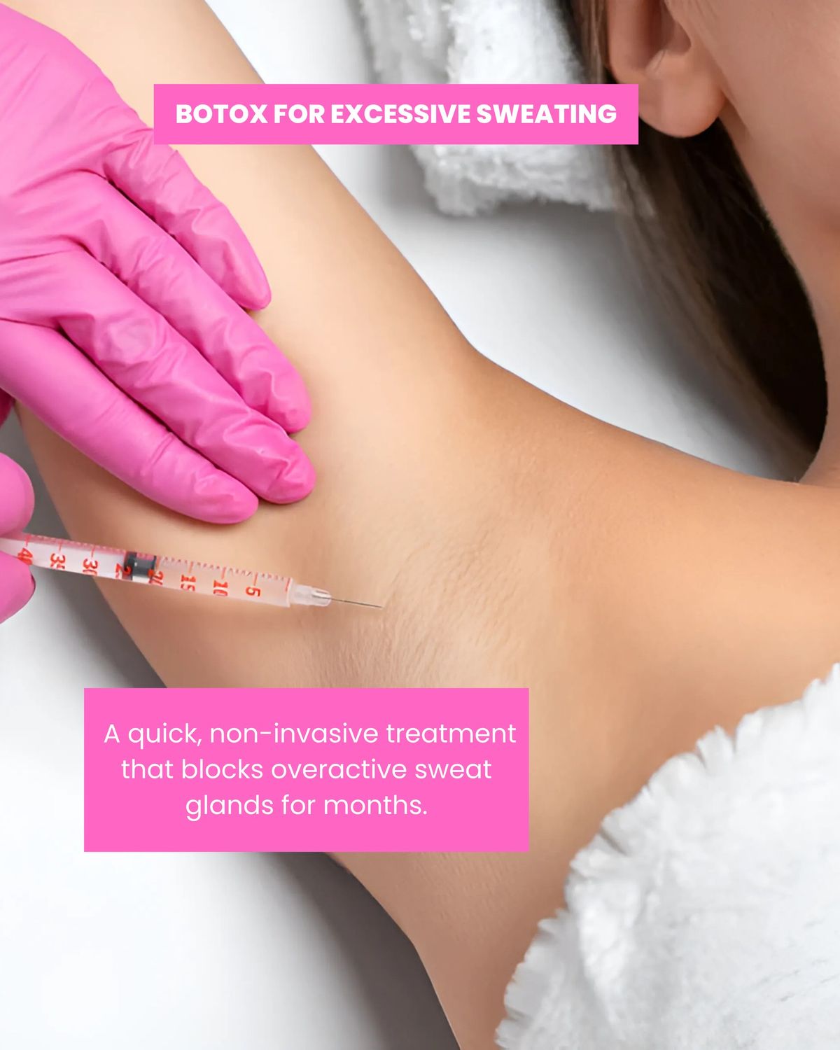 Dieu-Tri-Hoi-Nach-Bang-Botox-Tai-Spa-Clinic_Điều Trị Hôi Nách Bằng Botox Tại Spa Clinic 2.jpg
